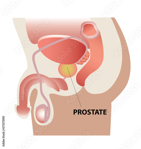 Prostate - Próstata