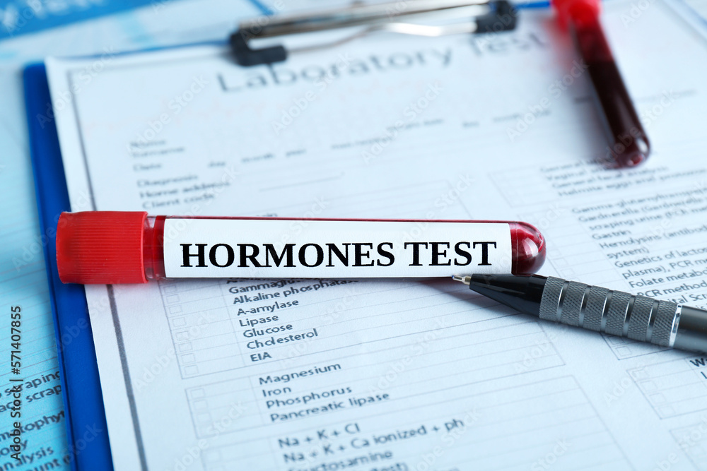 Hormones test. Sample tube with blood on laboratory form, closeup Hormones test. Sample tube with blood on laboratory form, closeup