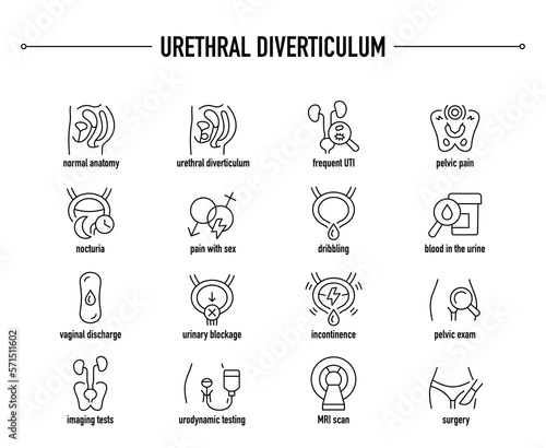 Urethral Diverticulum symptoms, diagnostic and treatment vector icon set. Line editable medical icons.