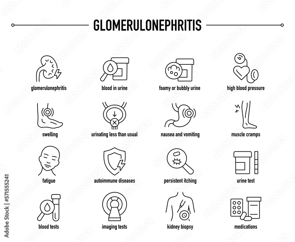 Glomerulonephritis symptoms, diagnostic and treatment vector icon set. Line editable medical icons.