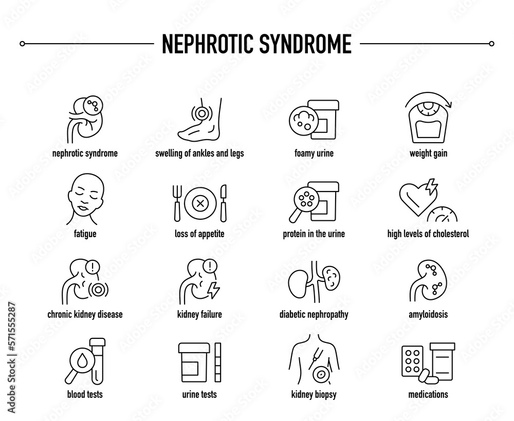 Nephrotic Syndrome symptoms, diagnostic and treatment vector icon set. Line editable medical icons.