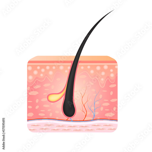 Hair has grown back into the skin surface after shaving. Anatomy infographics of hair and skin. File PNG 3D.