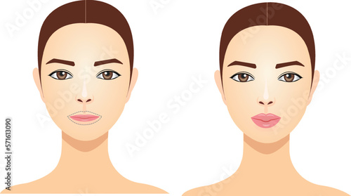 lip plastic, before after, vector