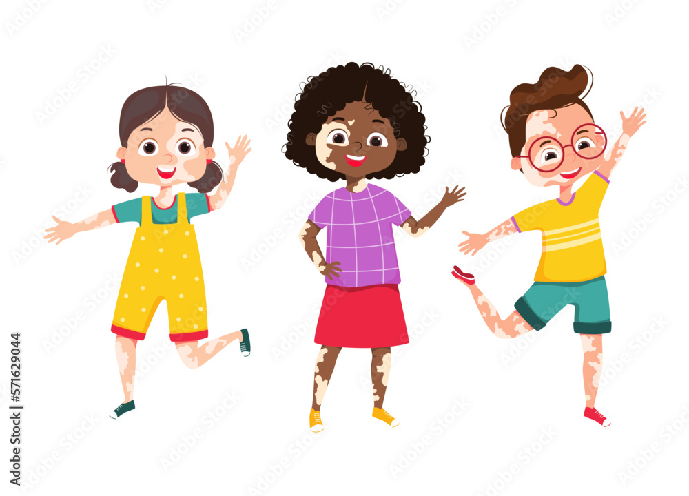 Happy Multiethnic kids with vitiligo cosmetology skin disease. Three kids with dermatologist spot pigment problem standing together. Body positive illustration. Cartoon Vector illustration