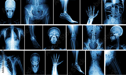 Many x-ray images of very good quality. photo