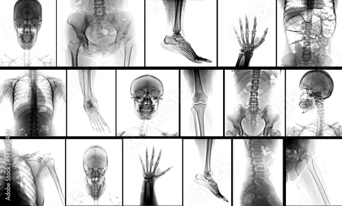 Many x-ray images of very good quality.