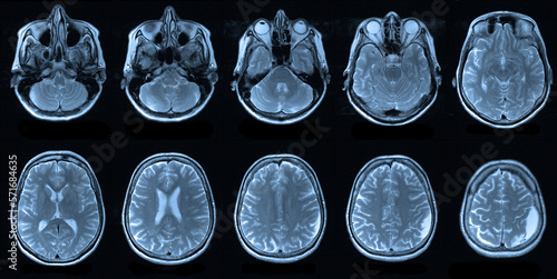 Obraz na płótnie x image of brain
