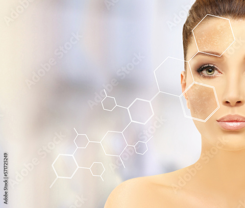 Canvastavla Dark spots, freckles,hyperpigmentation(melasma or chloasma),concept - skin light