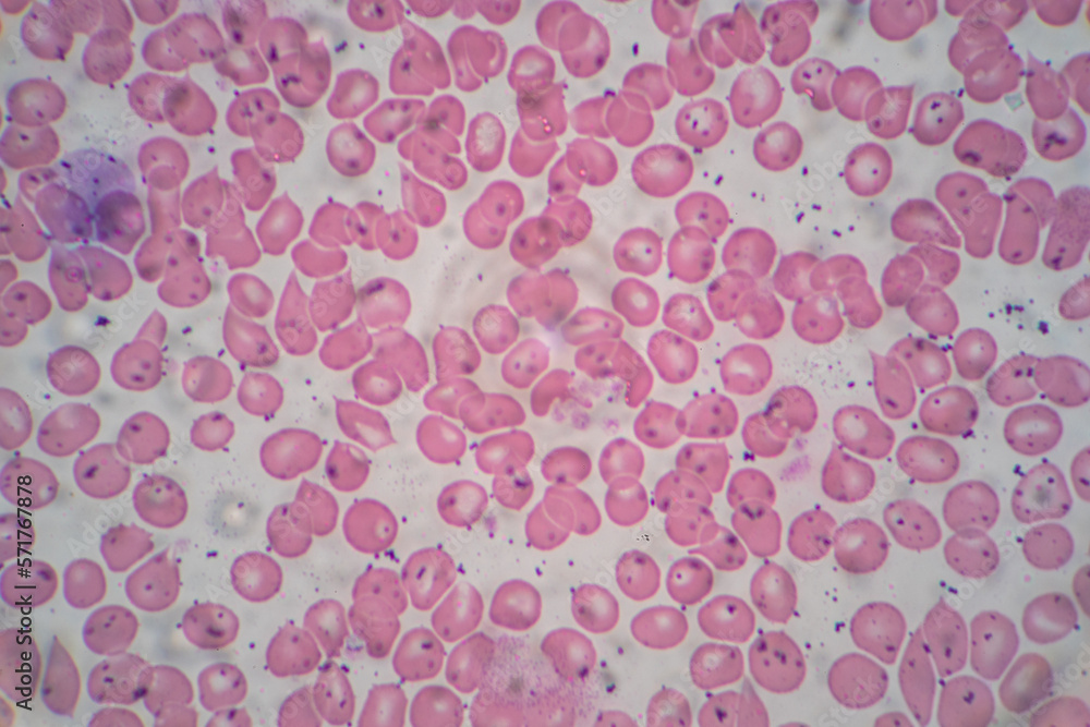 Human blood cells, Blood group and white blood cell study under microscopic. Human blood cells, Blood group and white blood cell study under microscopic.