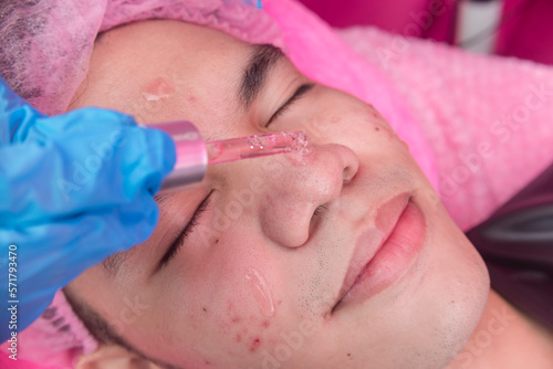 An Esthetician applies Diamond serum to the face of a patient. Facial rejuvenation procedure at a dermatology or aesthetic clinic. photo