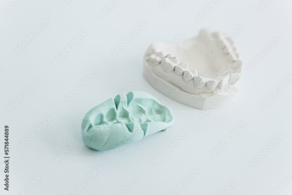 A cast of teeth. Plaster model of plaster of teeth. Dental plaster cast