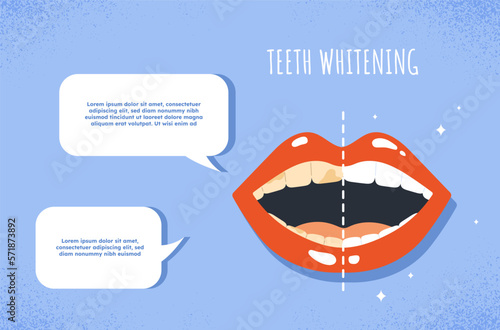 Teeth Whitening concept