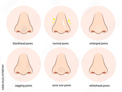 skin pores on human nose illustration. Isolated on white background.