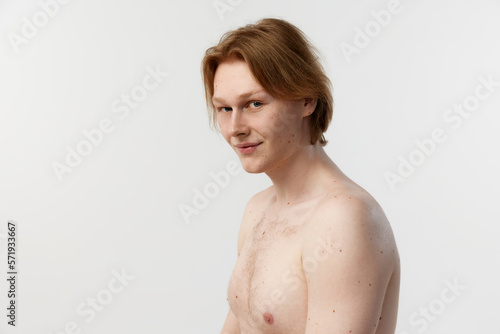 Side view portrait of young redhead man with moles on body posing shirtless over grey studio background. Body-positivity. Concept of men's health, body and skin care, hygiene and male cosmetology