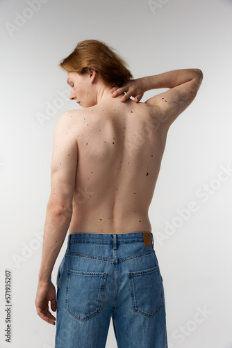 Rear view photo of young man posing shirtless in jeans over grey studio background. Moles on body, healthy strong back, spine. Concept of men's health, body and skin care, hygiene and male cosmetology