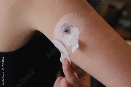 Applying the sticker for the blood glucose sensor  photo