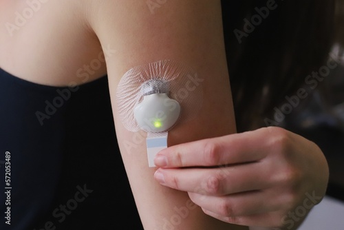 Inserted blood glucose sensor with transmitter and adhesive sticker