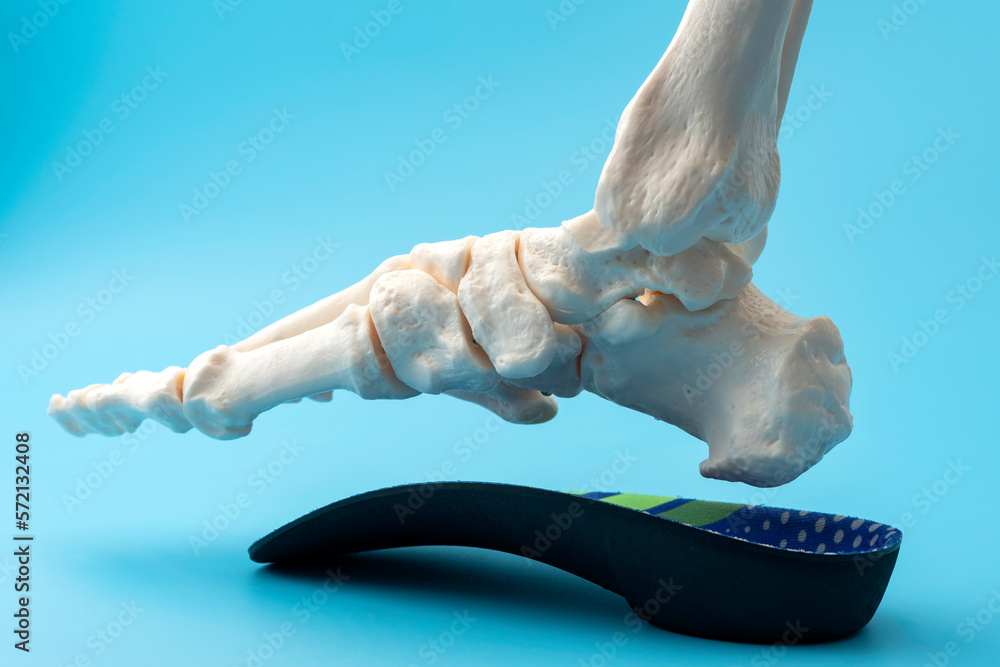 Anatomical model of the bones of the human foot wearing an orthopedic insole concept for Metatarsal health and treatment, Posture correction methods and Skeletal alignment improvement