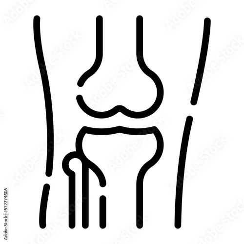 The�knee�is one of the largest and most complex�joints�in the body 