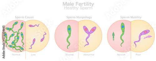 Male fertility, sperm healthy. Count, morphology, motility. Compare, normal, low, abnormal, poor. Collecting semen, movement shape. Microscopic cells. Test tube baby, IVF. Illustration vector