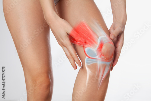 Knee meniscus inflamed, human leg, medically accurate representation of an arthritic knee joint 
