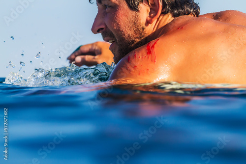 Surfer in ocean with blood on shoulder, Lakey Peak, central Sumbawa, Indonesia