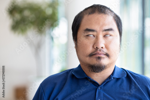 Face portrait of blind, visual-impaired asian man