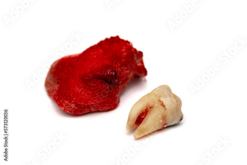 Quadro em tela One molar tooth extracted and placed on a white background