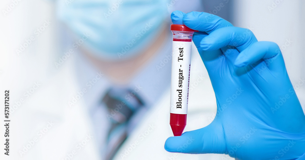 Doctor holding a test blood sample tube with Sugar test. Doctor holding a test blood sample tube with Sugar test.