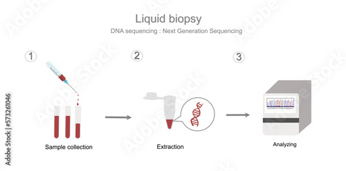 The workflow step of DNA sequencing with Next Generation sequencing technique in sample of liquid biopsy that represent in three simple step: Sample collection (blood), Extraction and Analyzing.