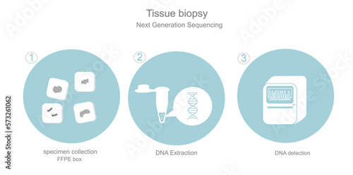 The workflow icon of DNA sequencing in Tissue biopsy with Next Generation Sequencing technique on blue and white concept that shows 3 step of specimen collection (FFPE), extraction and DNA detection.