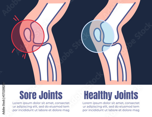 Healthy and injury joint muscle x ray concept. Vector graphic design illustration