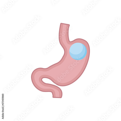 Obraz na płótnie Gastric balloon. Vector illustration on white background w salonie