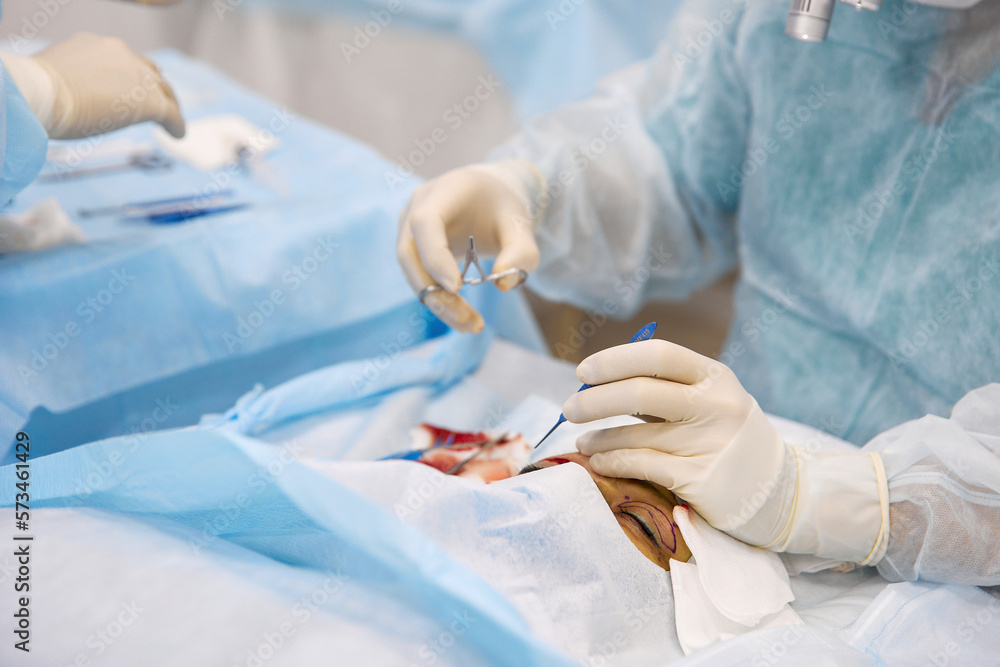 Doctor with tools doing eye surgery on patient at hospital Doctor with tools doing eye surgery on patient at hospital