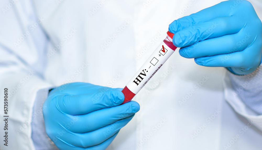Doctor's hand holds test tube in blood.Blood sample positive with HIV testing. Doctor's hand holds test tube in blood.Blood sample positive with HIV testing.
