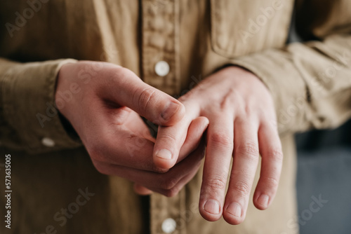 Bilde på lerret Close up of unhealthy young caucasian man suffering from arthritis in fingers