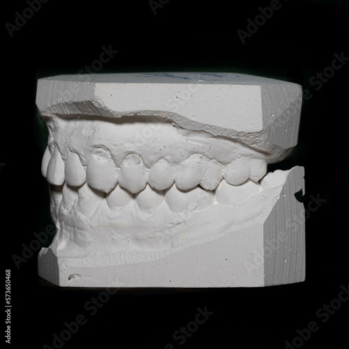 wycisk ortodontyczny