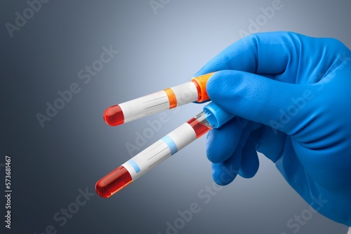 Blood sample tubes in hand, medical concept