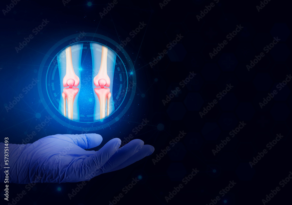 Joint pain, arthritis and tendon problems. human knees with