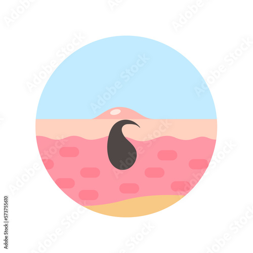 hair follicles on human skin hair disorder hair care