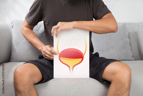 Photography The man holding white paper with pictures of bladder.