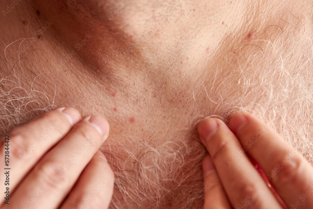 A man shaves the long gray hair on his chest. A man shaves the long gray hair on his chest.