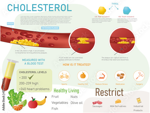 Cholesterol infographic, what it is, types, treatment and recommended and forbidden foods with corresponding icons on white background.
