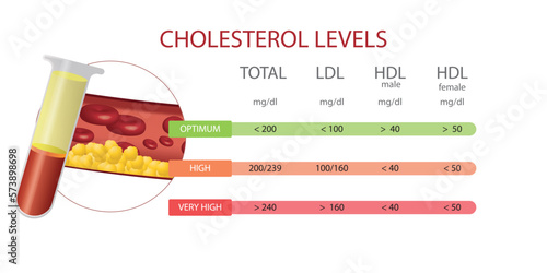 Infographic of cholesterol levels, optimal low, and very high With image of artery and cholesterol deposited in it. Vector Eps 10