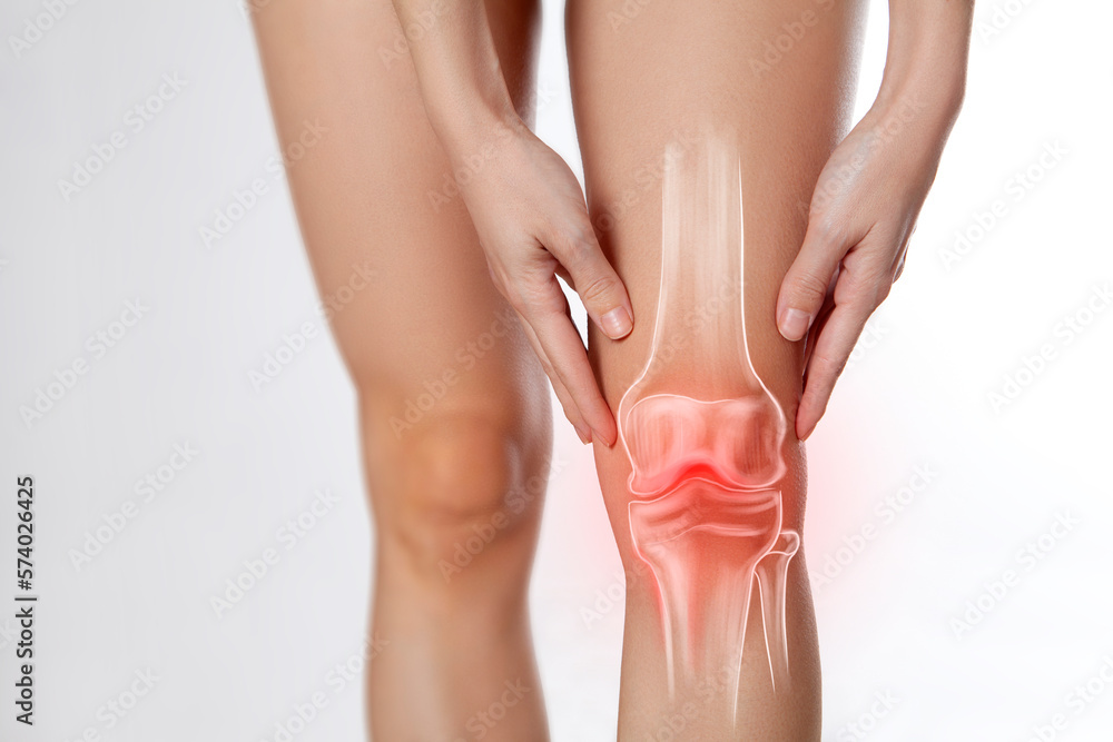 Knee pain, meniscus inflamed, human leg medically accurate representation of an arthritic knee joint. Persistent, sharp discomfort in the knee joint, accompanied by swelling and stiffness - obrazy, fototapety, plakaty 