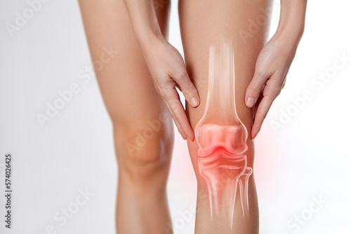 Fototapete Knee pain, meniscus inflamed, human leg medically accurate representation of an arthritic knee joint