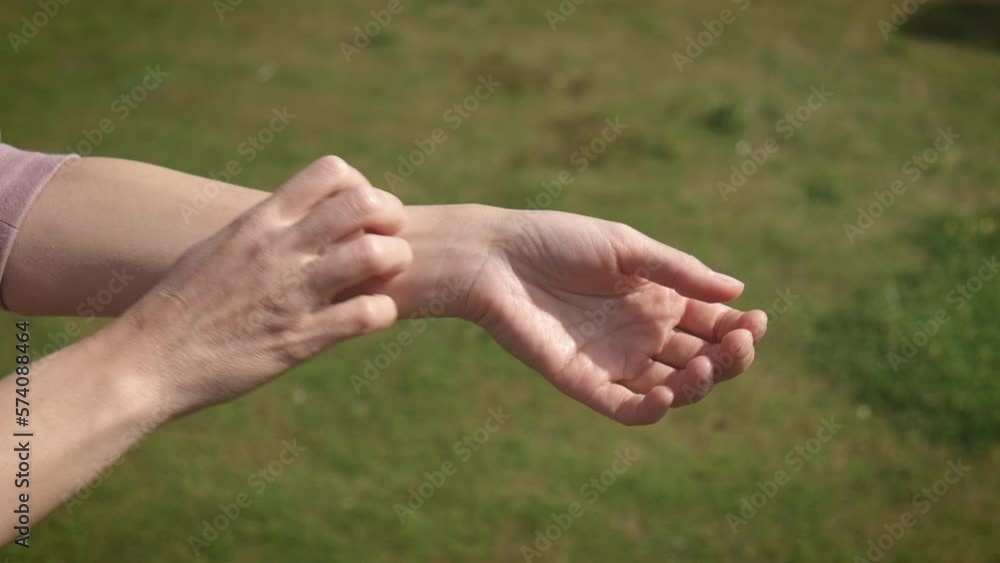 The female scratches her hand, insect bites. Allergic reaction to insect bites, dermatitis. Allergy rash The female scratches her hand, insect bites. Allergic reaction to insect bites, dermatitis. Allergy rash