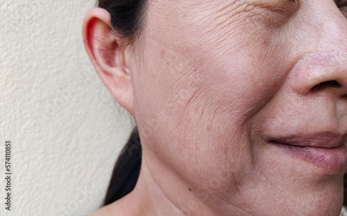 portrait wrinkle and Flabbiness skin beside the eyelids, smile lines beside the mouth, problem dark spots and blemish on the face of woman's, health care and beauty concept.