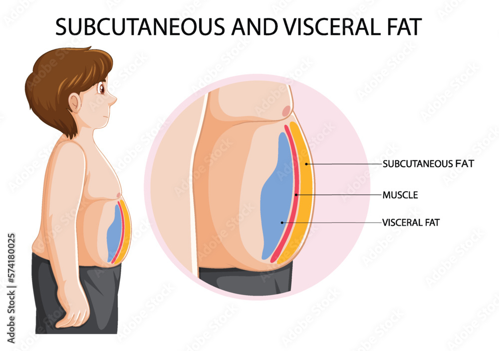 Subcutaneous and visceral fat diagram Stock Vector | Adobe Stock
