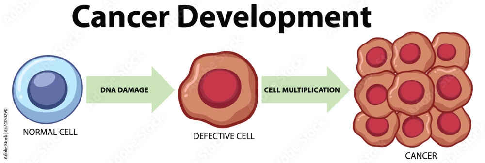 Tumor cell and cancer development Stock Vector | Adobe Stock